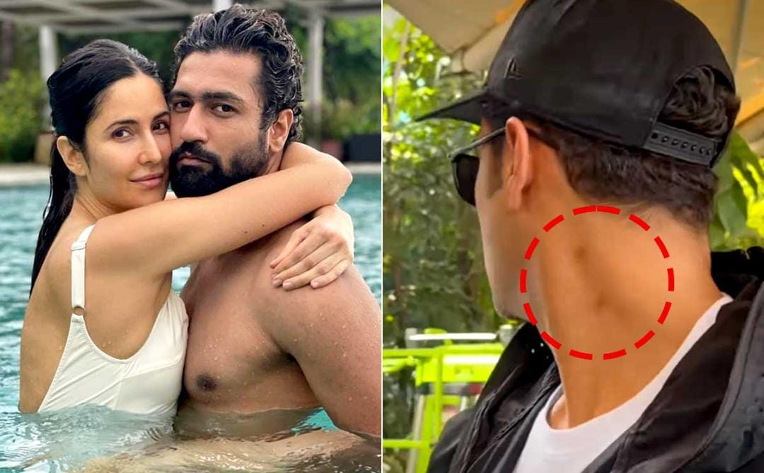 ভ্যালেন্টাইন উইকে ফাঁস বেডরুম সিক্রেট , ভিকির গলায় লাভ বাইট , কৌতূহল অনুরাগীদের