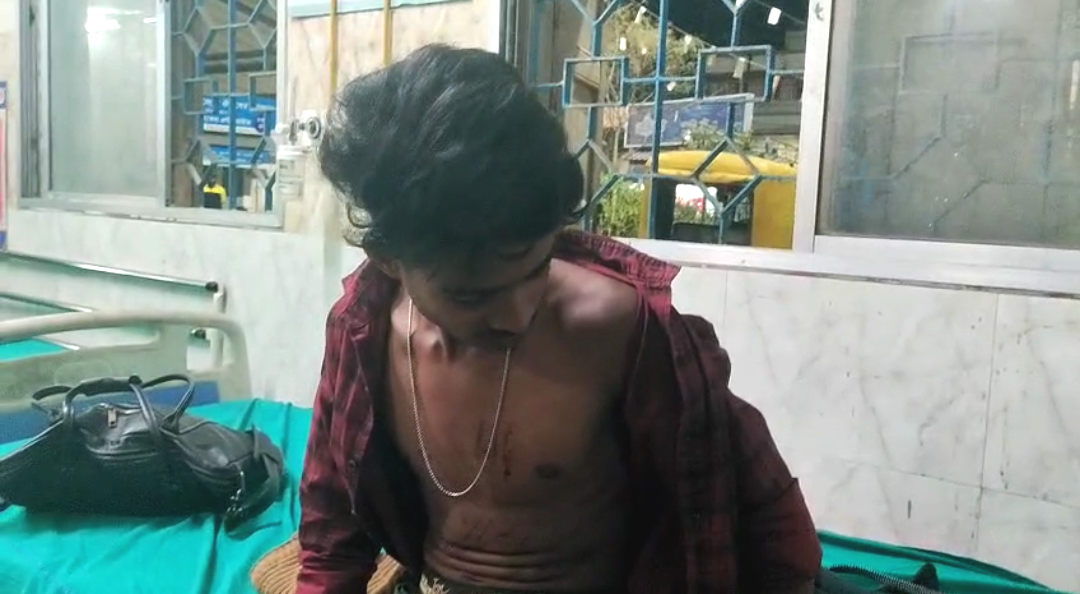 মাতলা ব্রিজে নাবালককে ব্লেড দিয়ে ক্ষতবিক্ষত করে ছিনতাই ,