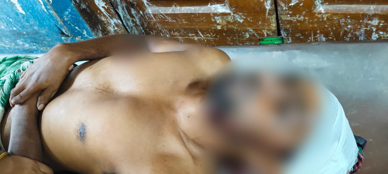 ড্রেনের স্লাব ভাঙাকে কেন্দ্র করে তৃণমূলের দুই গোষ্ঠীর সংঘর্ষ , আহত ৭