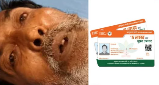 ভাঙা কোমর, চিকিৎসার খরচ দেড় লাখ ! এক কার্ডেই বিনামূল্যে অপারেশন জলপাইগুড়ির বৃদ্ধের