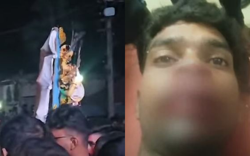 বিসর্জনের আবহে ভিলেজ পুলিশের দাদাগিরি , জ্বলন্ত বাজিতে গুরুতর জখম যুবক