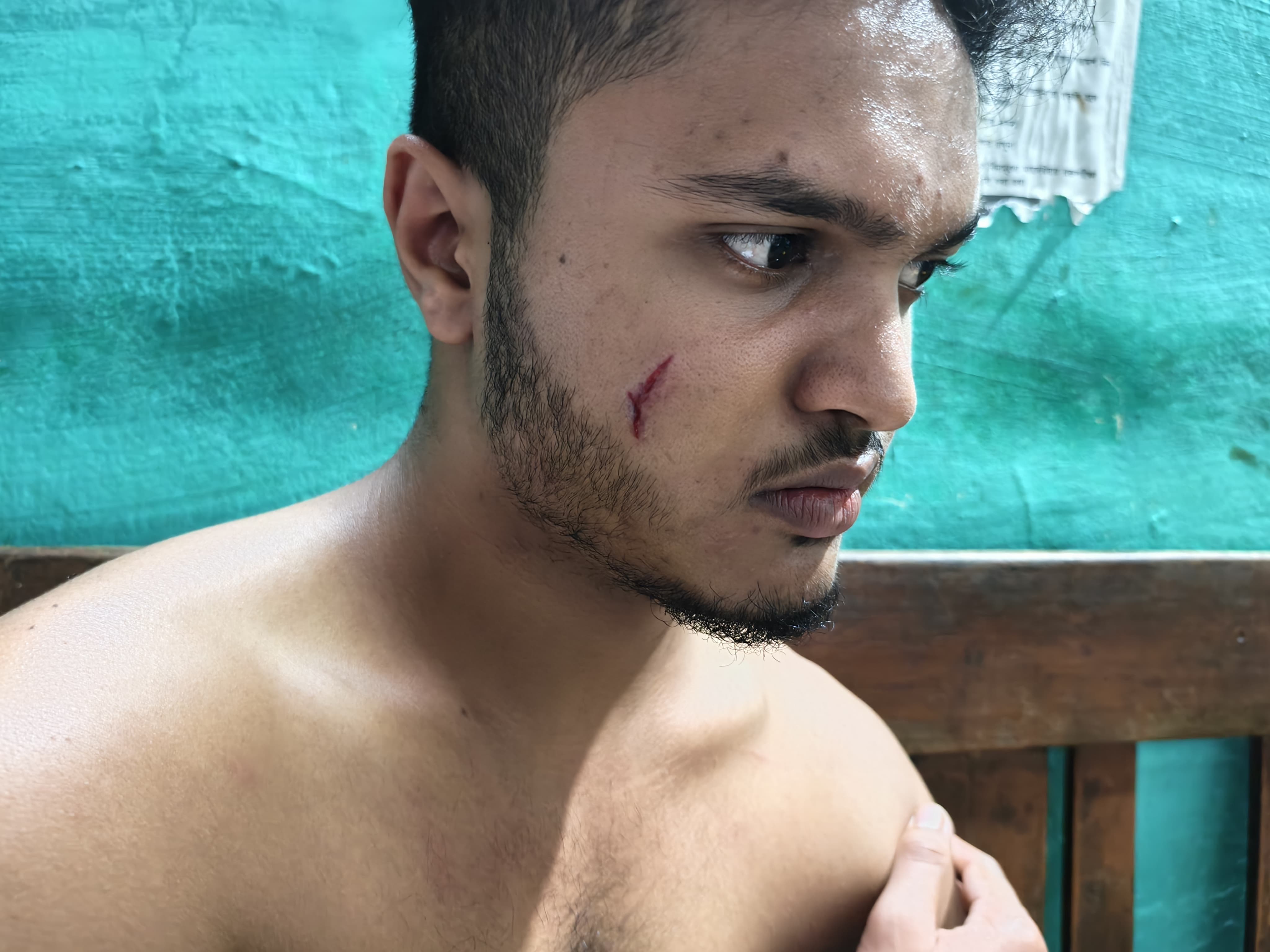 দায়ের আঘাতে রক্তাক্ত তৃণমূল ব্লক সভাপতির ঘনিষ্ঠ যুবক! উত্তপ্ত বামনহাট অফিসপাড়া