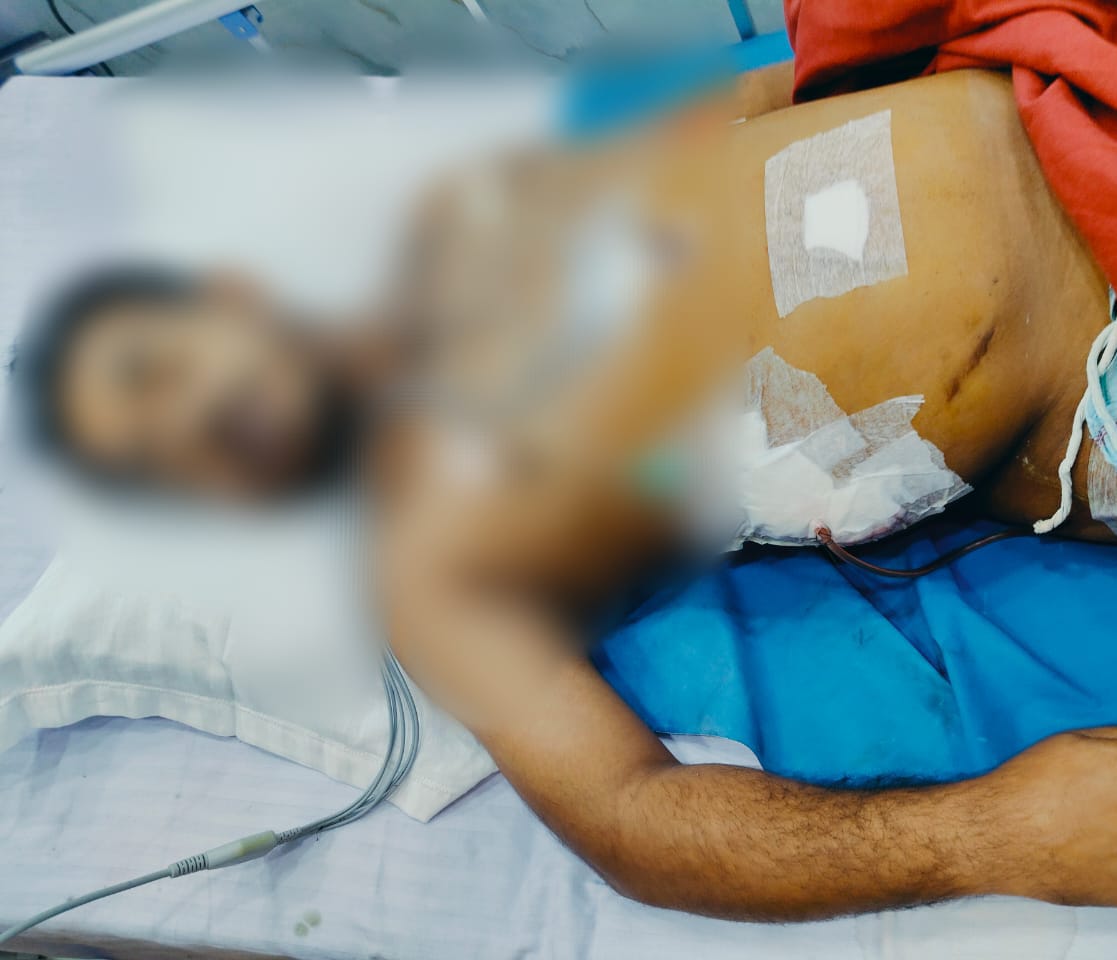 বি.সি.হাসপাতালে রোগীর রহস্যমৃত্যু ঘিরে উত্তেজনা , চিকিৎসায় গাফিলতির অভিযোগ পরিবারের