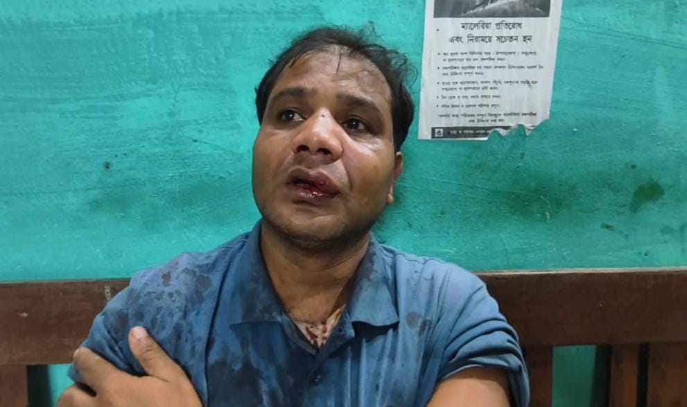 সাইকেলের বেল বাজাতেই আচমকা হামলা দুষ্কৃতীদের , গুরুতর অবস্থায় হাসপাতালে যুবক