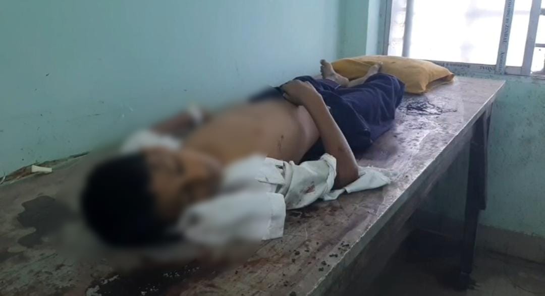 বেপরোয়া টোটোর ধাক্কায় মৃত সপ্তম শ্রেণীর এক ছাত্র , গ্রেফতার চালক