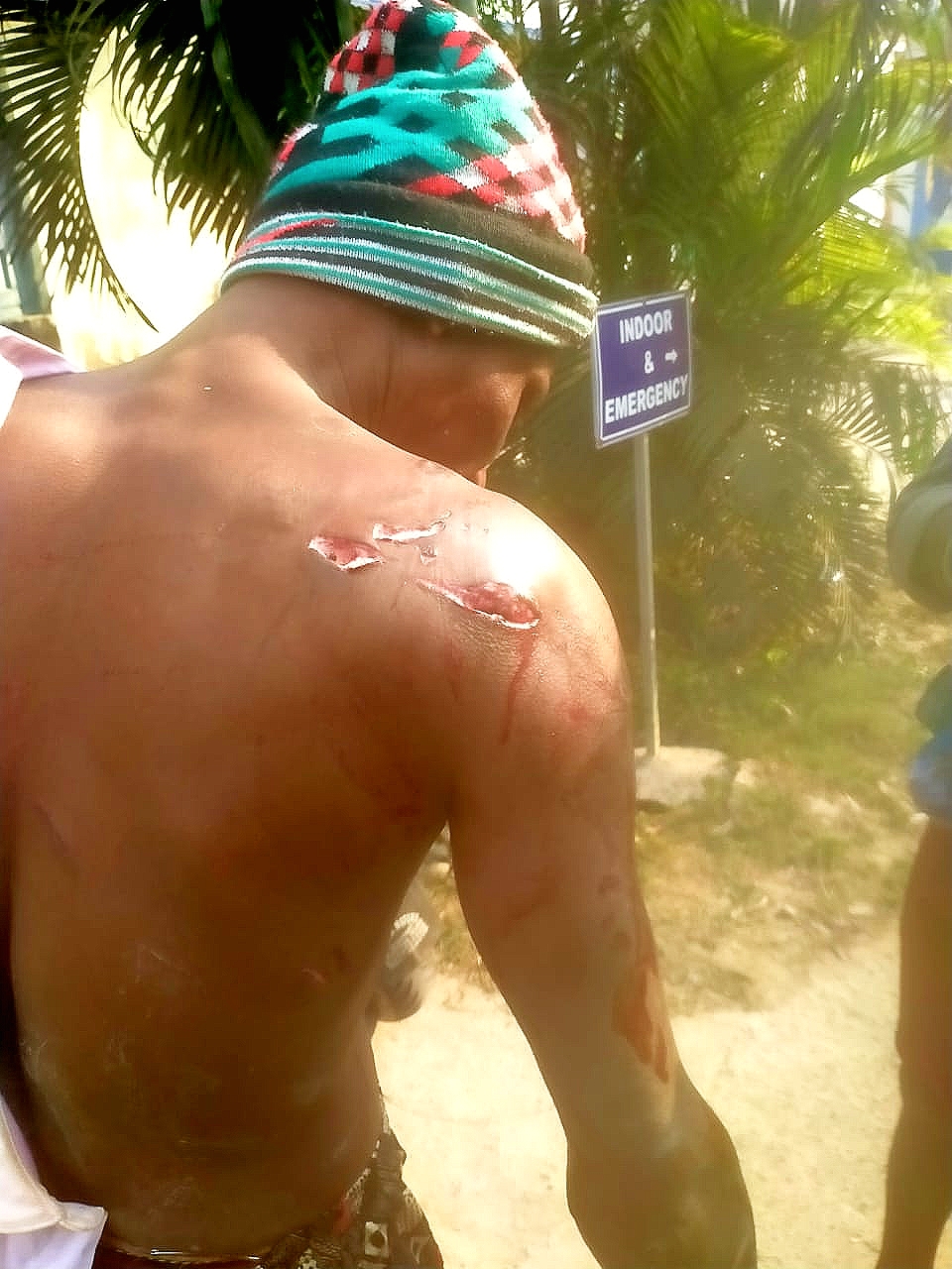 পেটের দায়ে সুন্দরবনে , কাঁকড়া ধরতে গিয়ে বাঘের হানায় গুরুতর জখম মৎস্যজীবী