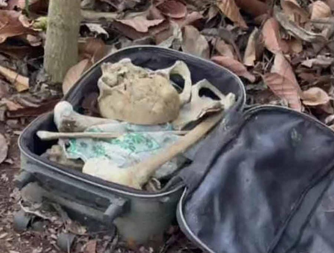 স্যুটকেস থেকে কঙ্কাল উদ্ধারের পর রহস্যের কিনারা , দম্পতির মুখোশ ছিঁড়ল পুলিশ