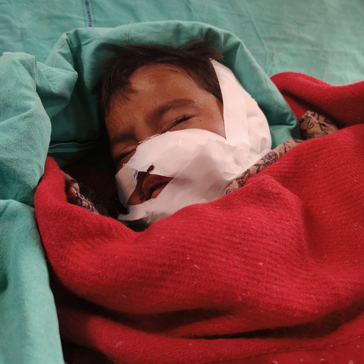 ছোট বাচ্চার প্রতি নৃশংসতা , শিশুকে মৃত্যুর মুখ থেকে ফিরিয়ে আনলেন চিকিৎসকরা