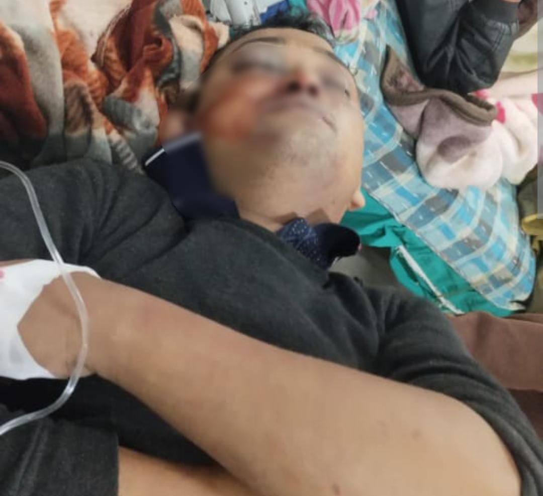 মৃতদেহ পোড়াতে গিয়ে মর্মান্তিক পরিণতি , অপর পক্ষের হাতে খুন যুবক